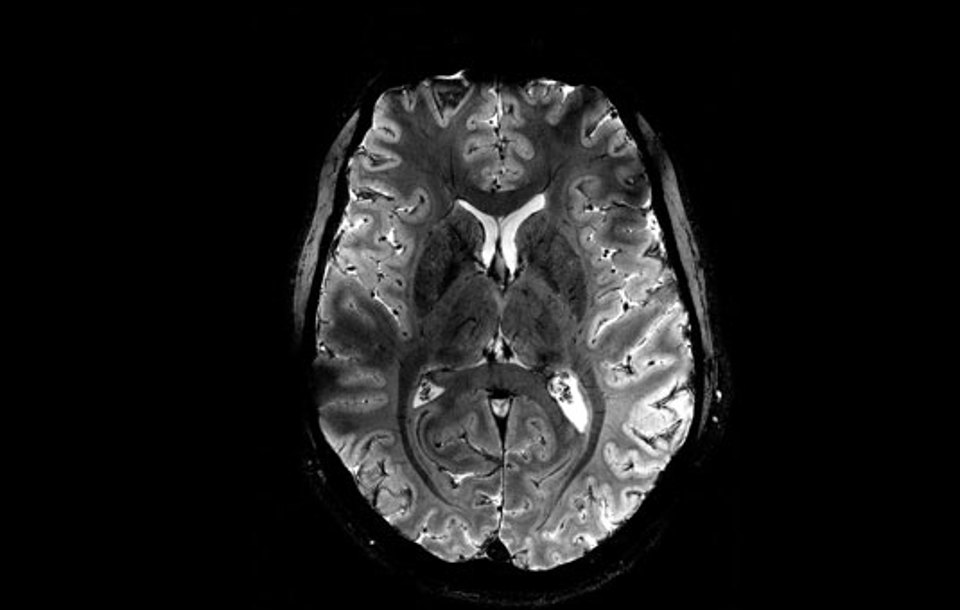                                               Дэлхийн хамгийн хүчирхэг MRI сканерын анхны зургууд 